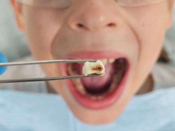 Best Emergency Orthodontic Services in Pearisburg, VA