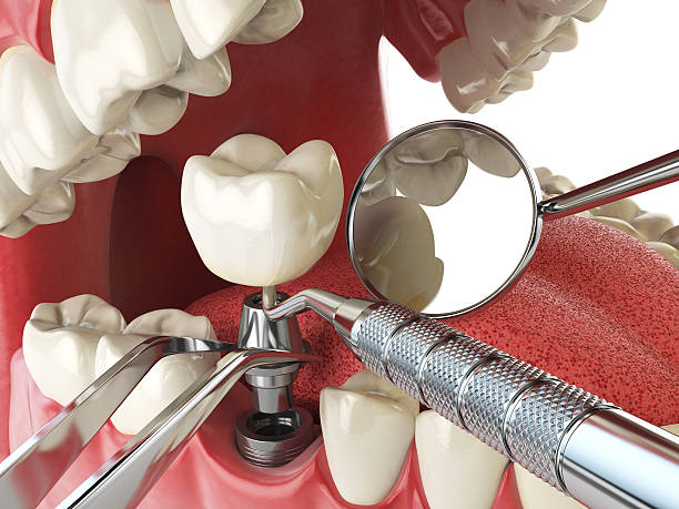 Best Cosmetic Emergency Dentistry in Pearisburg, VA